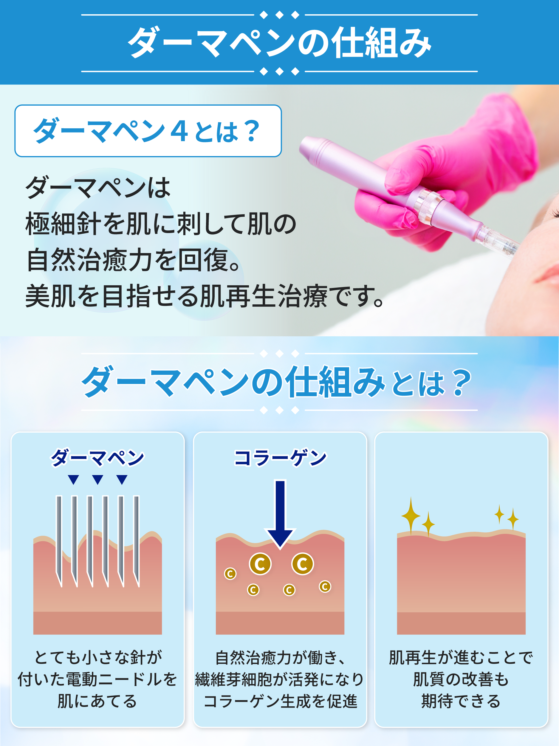 ダーマペンの仕組み